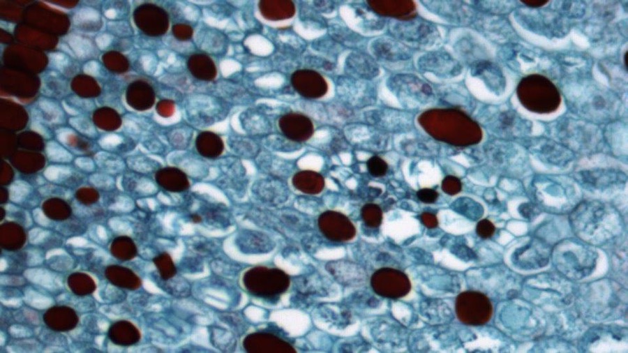 uScope Sharpen Filter Microscopes Intl.