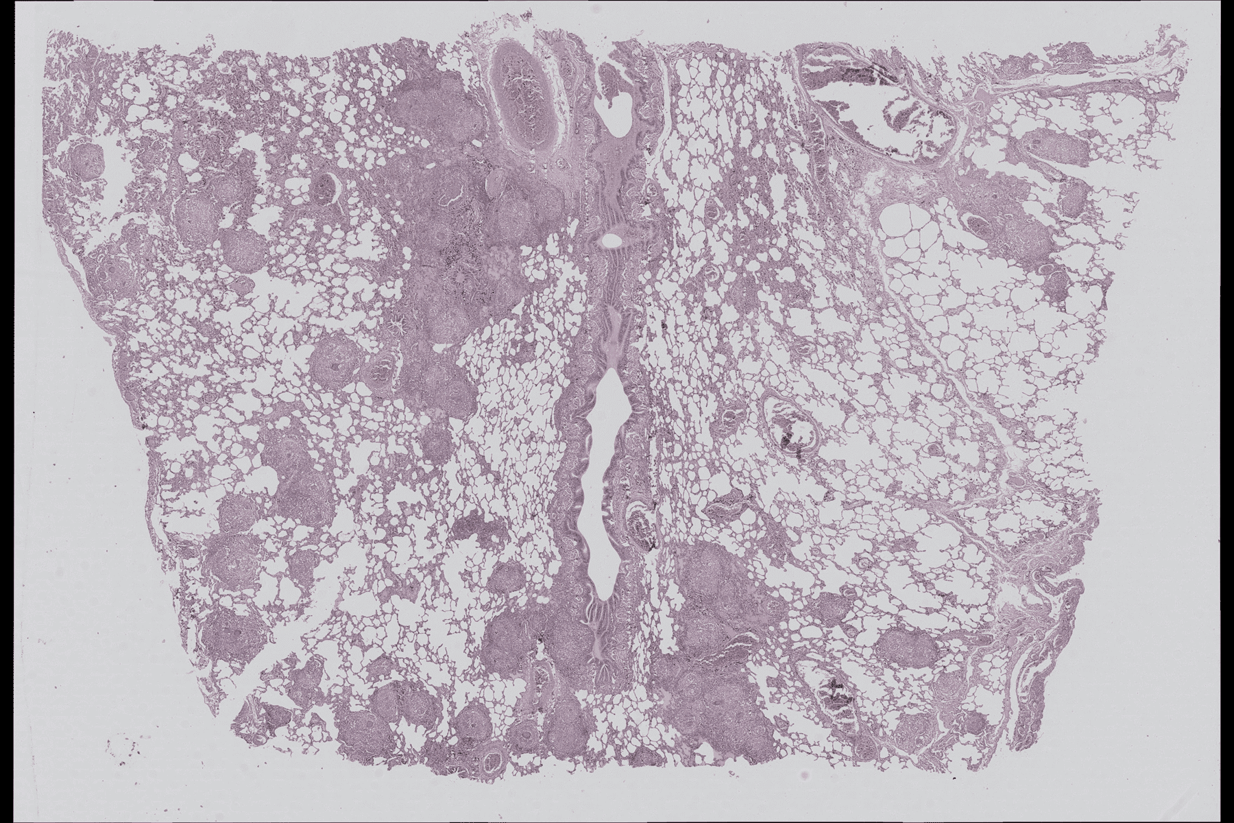Human Lung Tuberculosis Whole Slide Image Viewer-uScopeHXII 40x (0.80NA ...